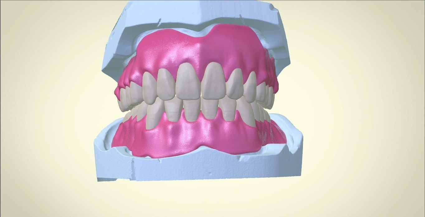 Full Dentures With Many Production Options 3D print model_21