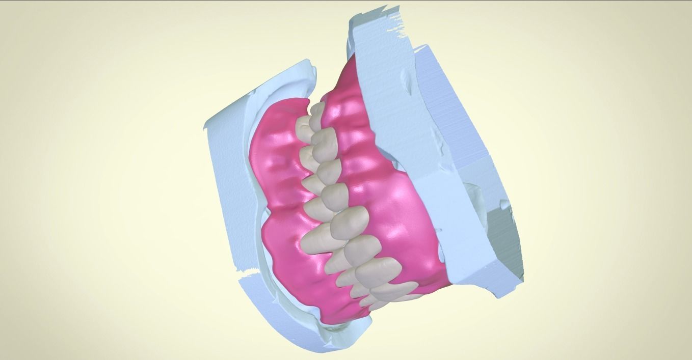Full Dentures With Many Production Options 3D print model_18