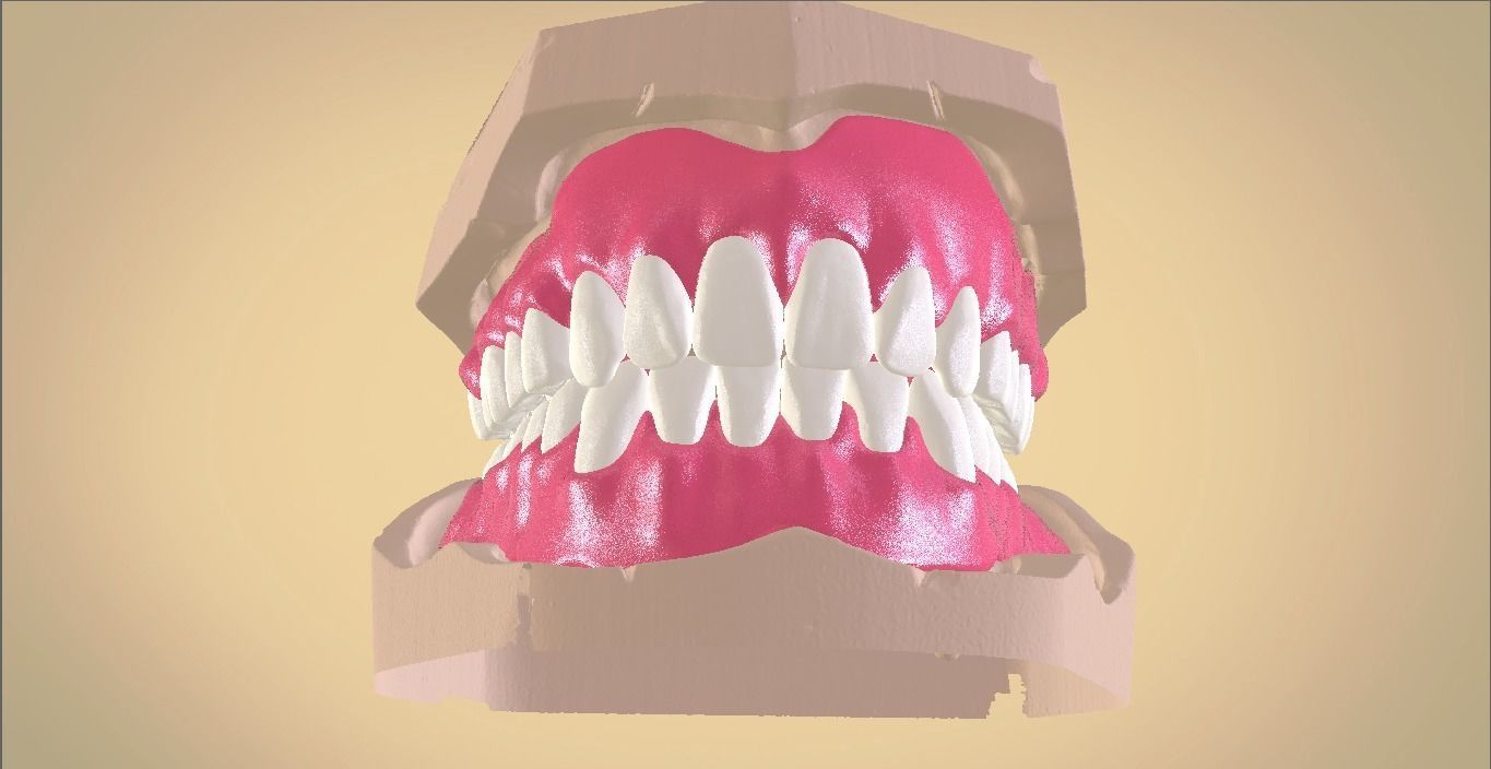 Full Dentures With Many Production Options 3D print model_6