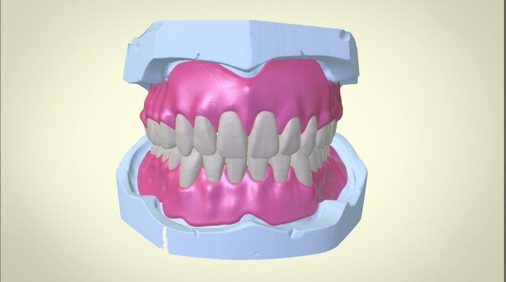 Full Dentures With Many Production Options 3D print model_2