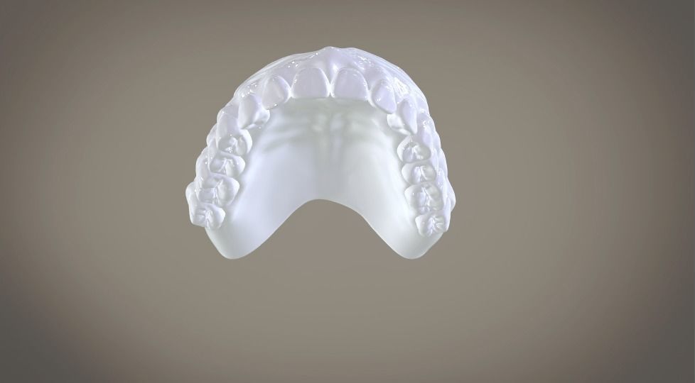 Full Dentures With Many Production Options 3D print model_20