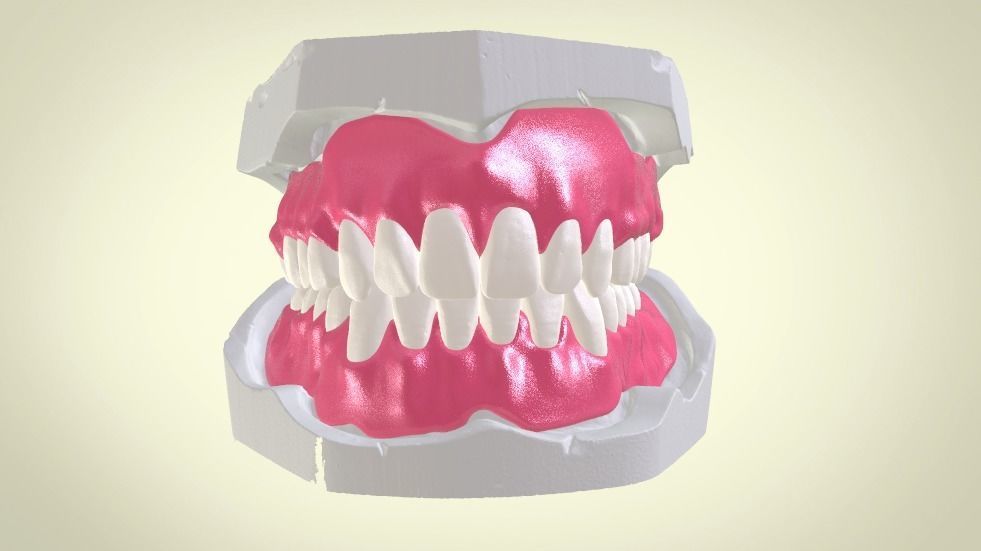 Full Dentures With Many Production Options 3D print model_3
