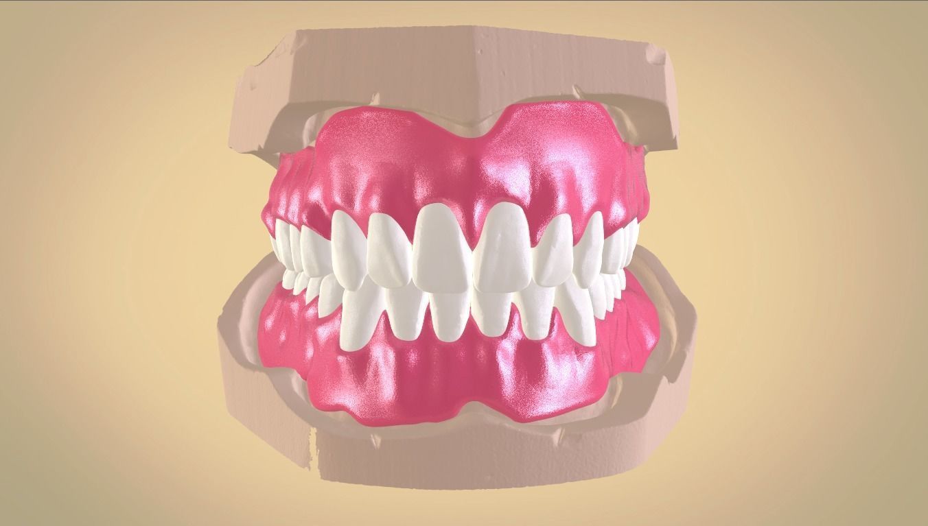 Full Dentures With Many Production Options 3D print model_14
