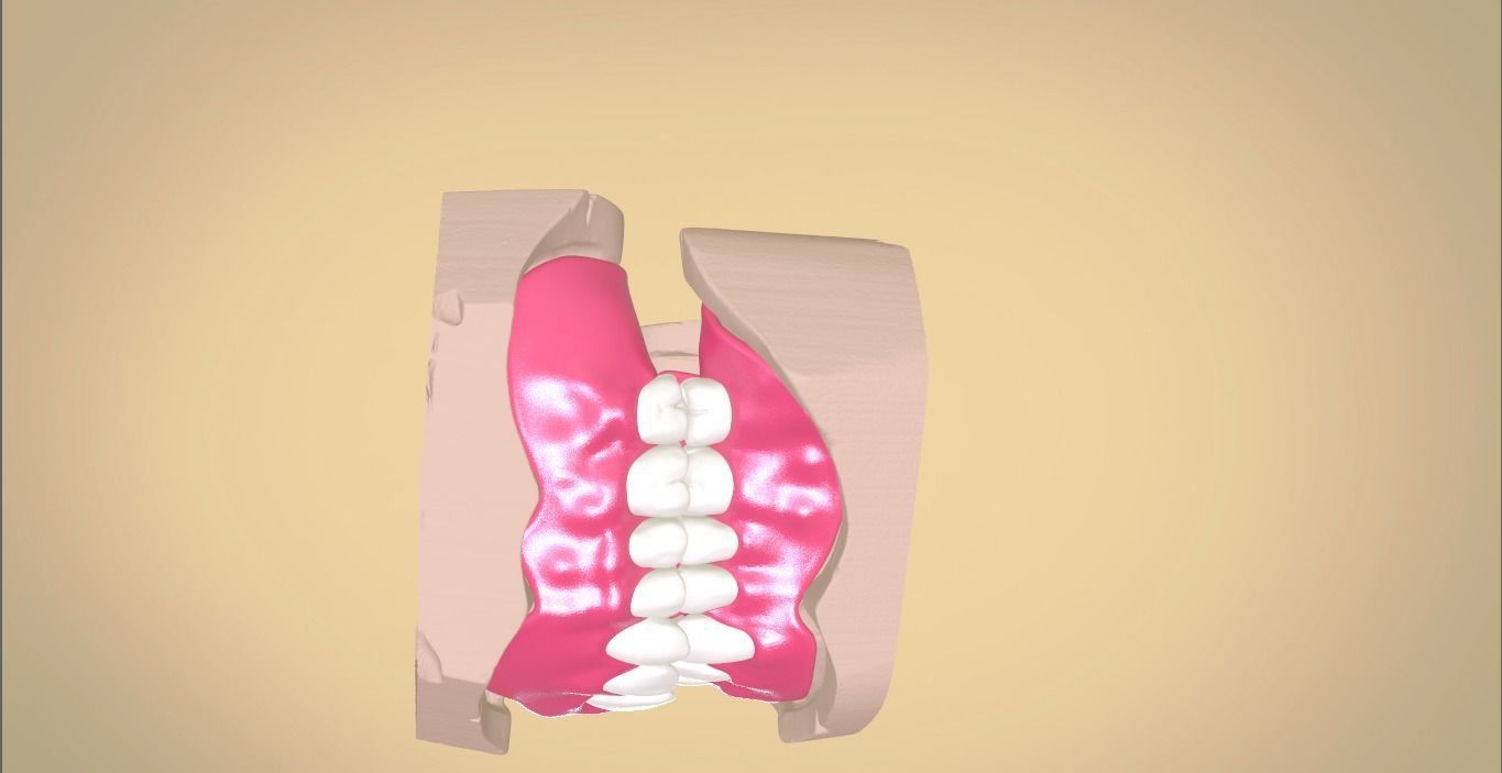 Full Dentures With Many Production Options 3D print model_4