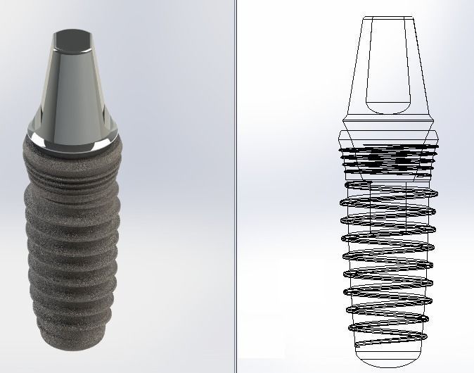 dental implant  Free 3D model_1