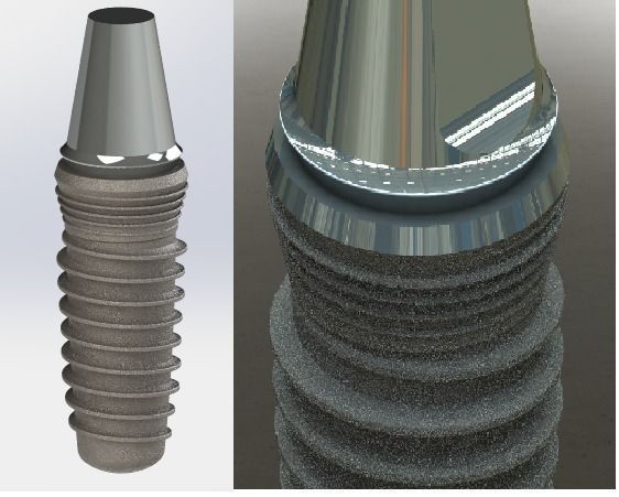 dental implant  Free 3D model_2