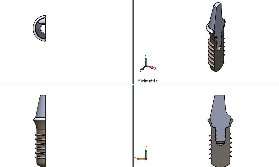 dental implant abutement Free 3D model
