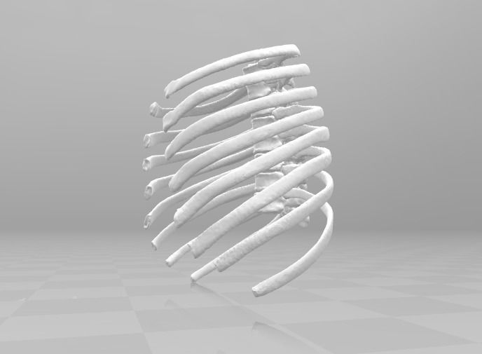 Female T3-T10 ribcage 3D model_1