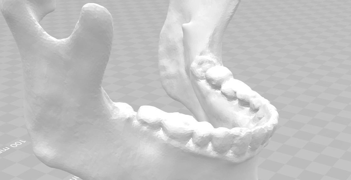 Lower jaw - male  3D model_1