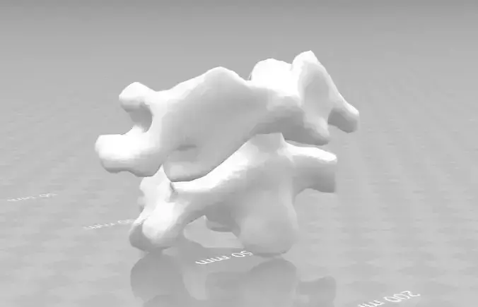 Atlas and Axis cervical vertebrae