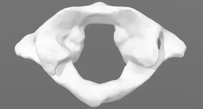 C1 first cervical vertebra  -  male