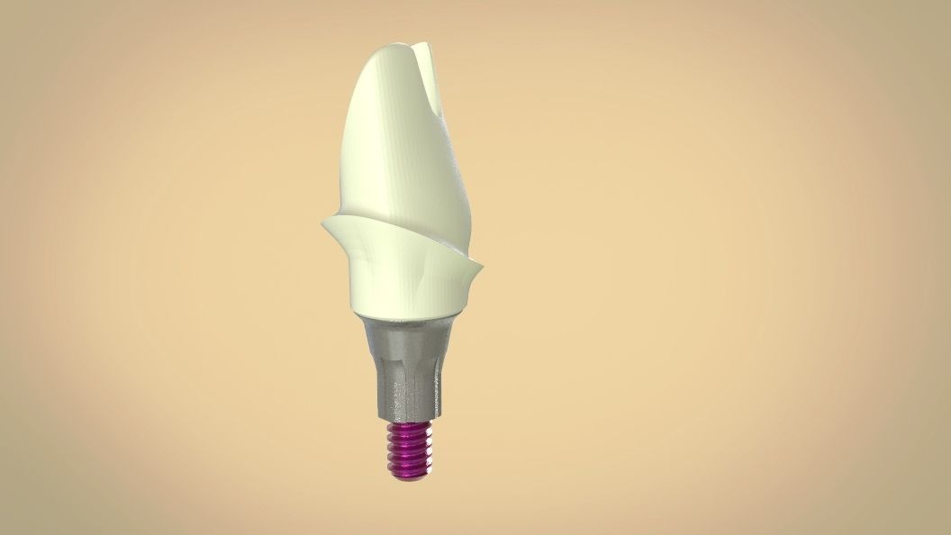Digital Screw Retained Abutment 3D print model_6