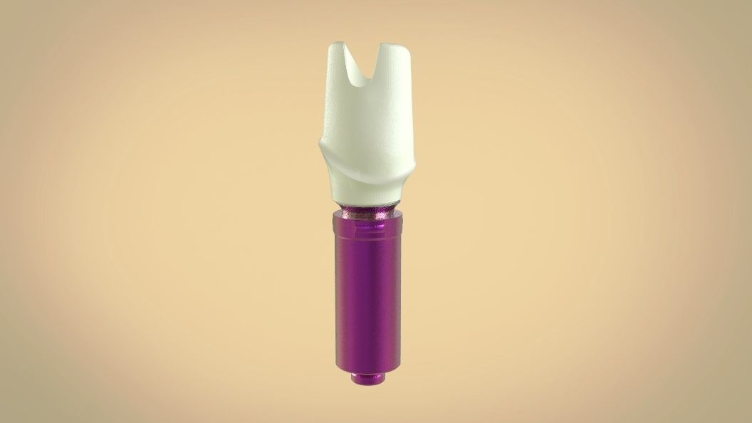 Digital Screw Retained Abutment 3D print model_13