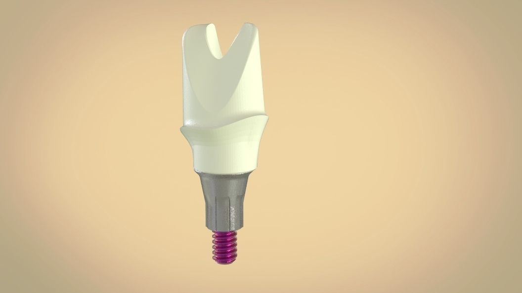 Digital Screw Retained Abutment 3D print model_7