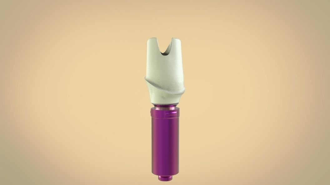 Digital Screw Retained Abutment 3D print model_17