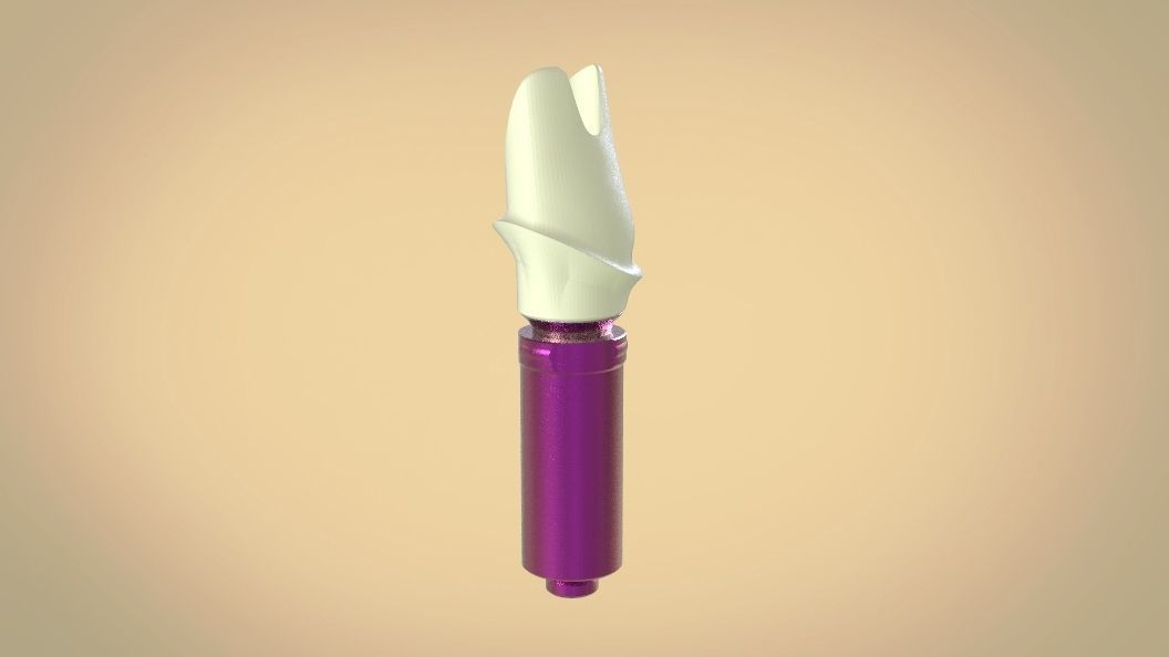 Digital Screw Retained Abutment 3D print model_14