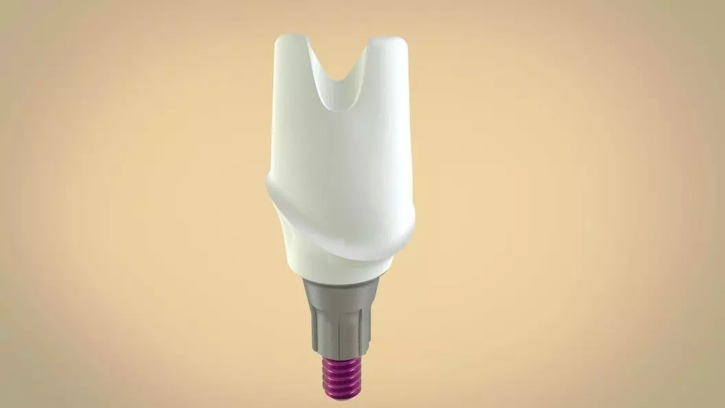 Digital Screw Retained Abutment 3D print model_0
