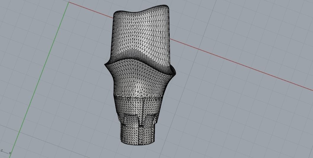 Digital Customised  Abutment  3D print model_2