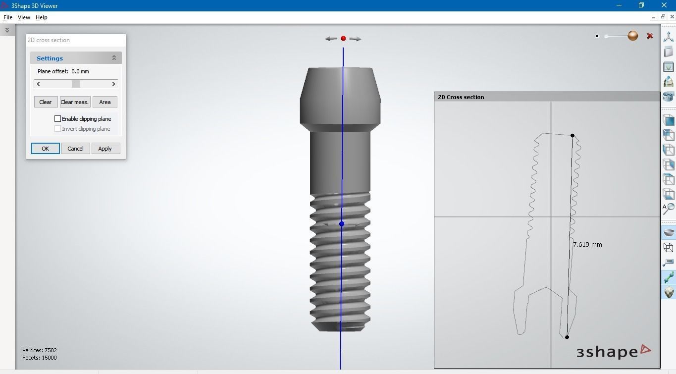 Digital Customised  Abutment  3D print model_14