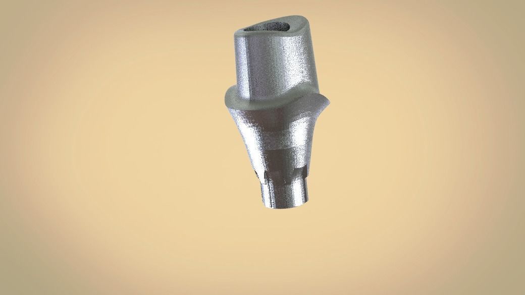 Digital Customised  Abutment  3D print model_1
