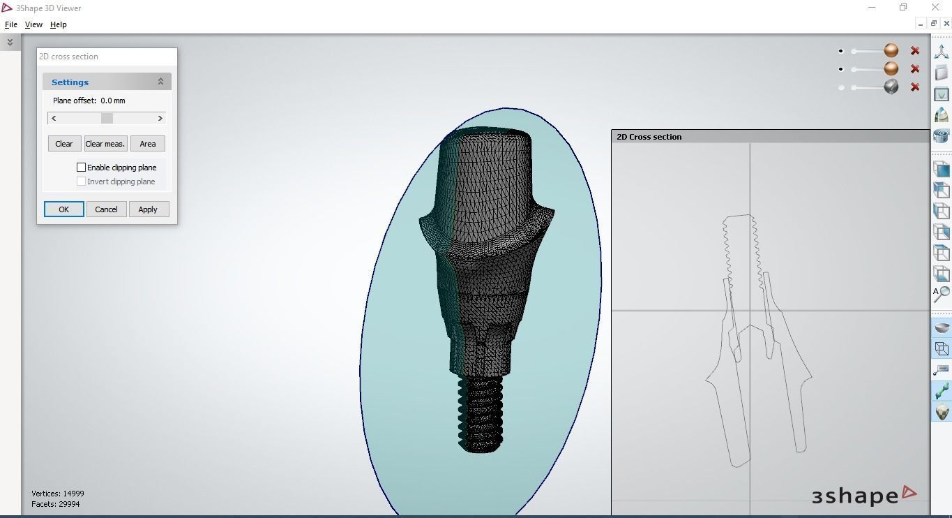 Digital Customised  Abutment  3D print model_19