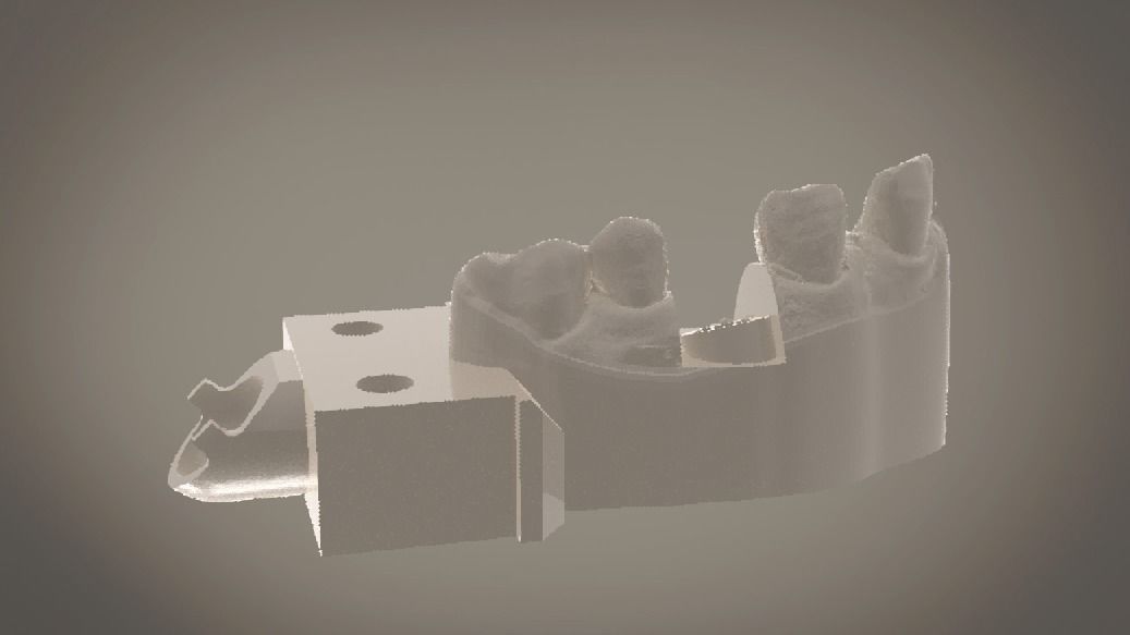 Digital Implant Model with Soft Tissue 3D print model_18
