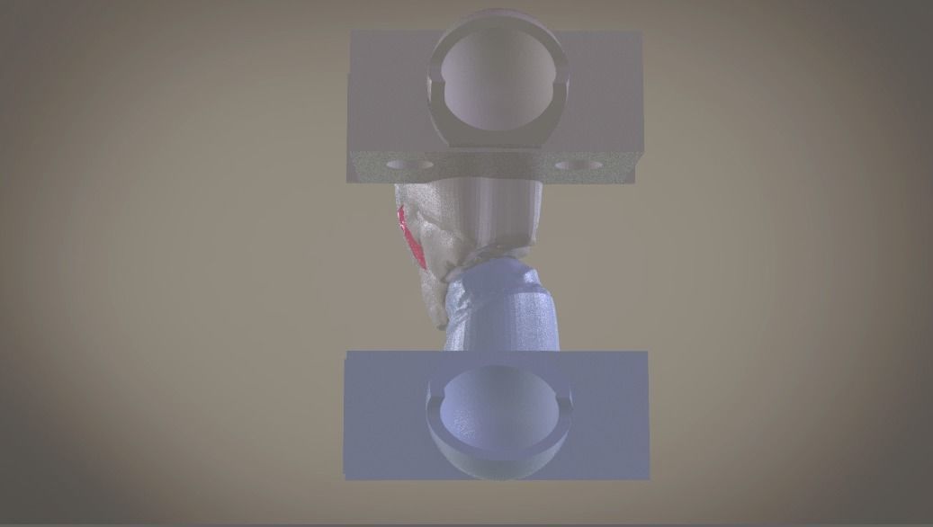 Digital Implant Model with Soft Tissue 3D print model_3