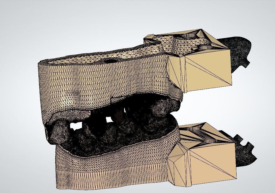 Digital Implant Model with Soft Tissue 3D print model_12