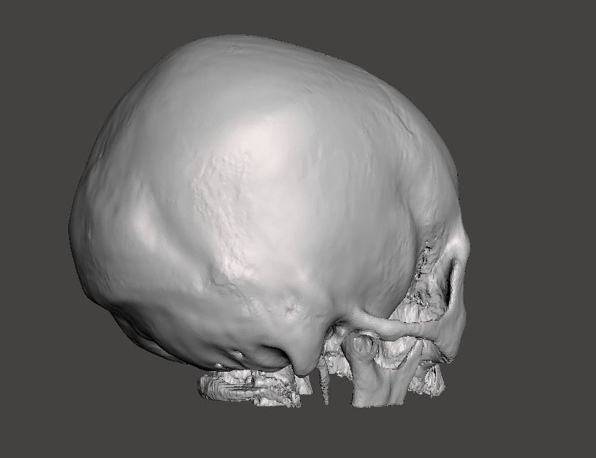 Skull female - age 78 Free 3D model_10