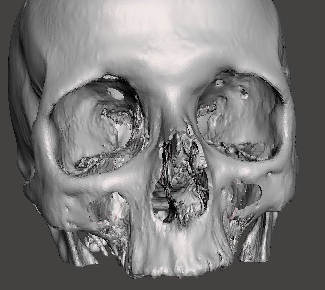 Skull female - age 78 Free 3D model_5