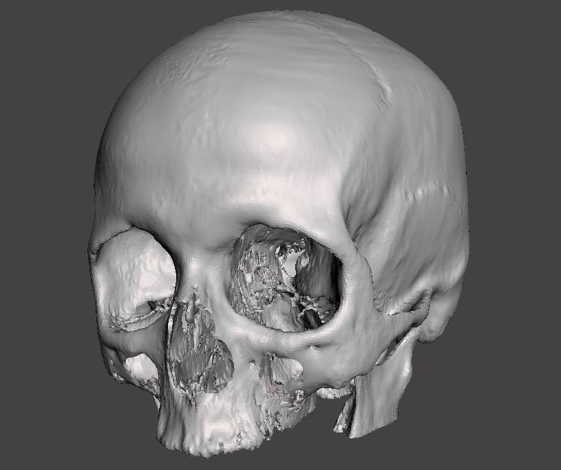 Skull female - age 78 Free 3D model_12
