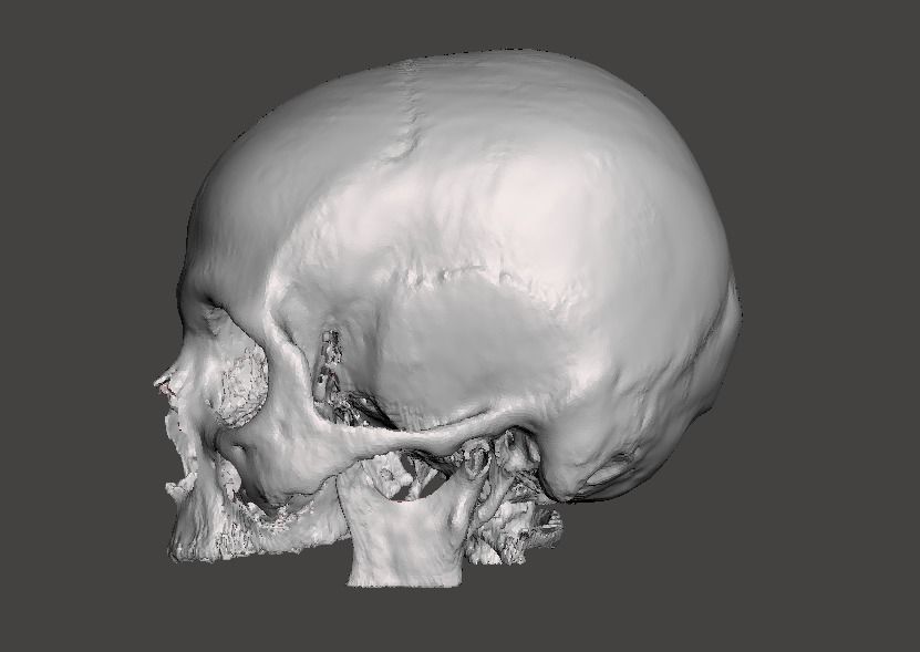 Skull female - age 78 Free 3D model_4