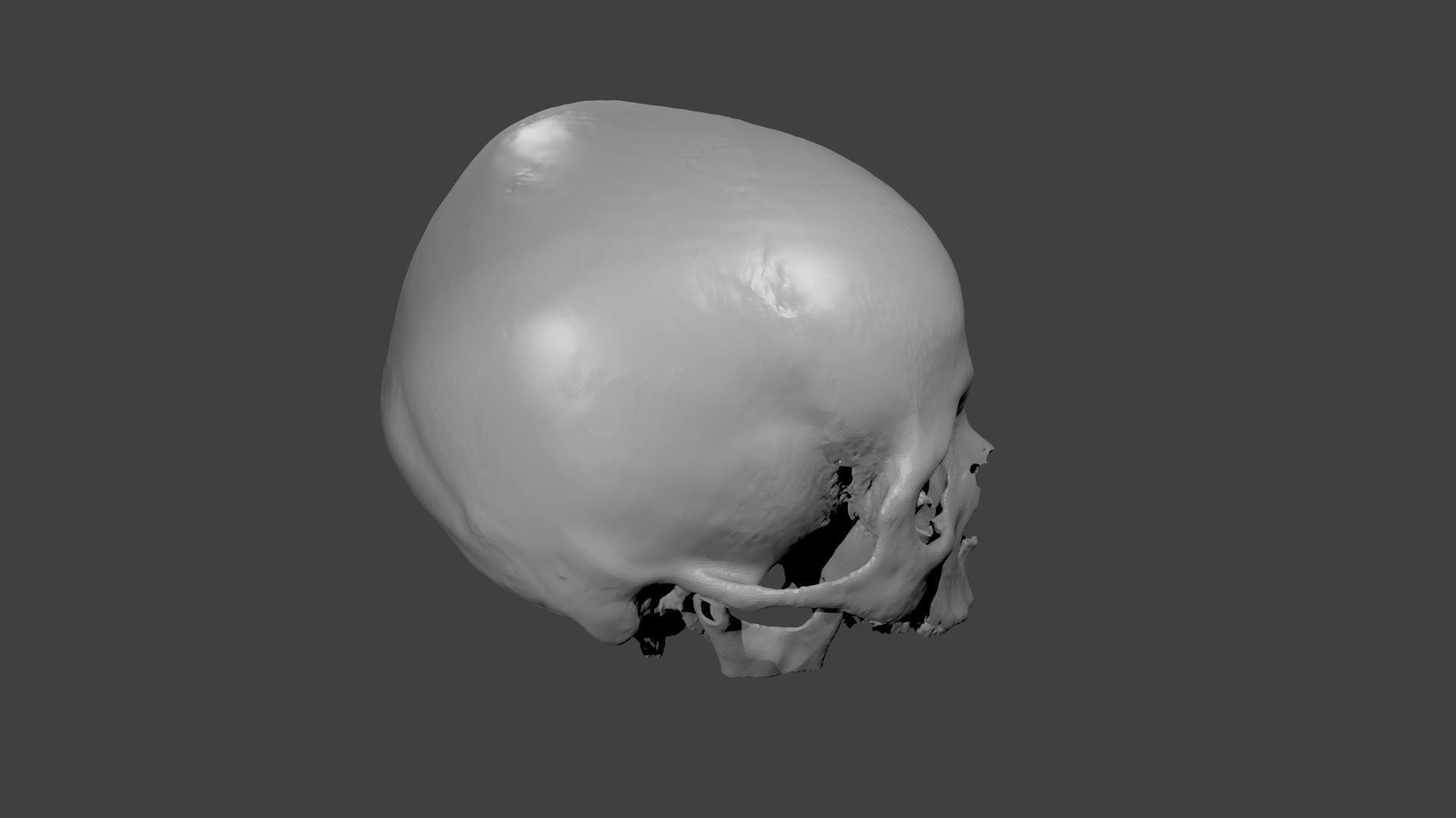 Skull female - age 78 Free 3D model_1