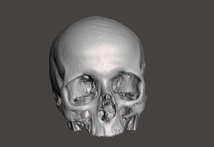 Skull female - age 78 Free 3D model_3