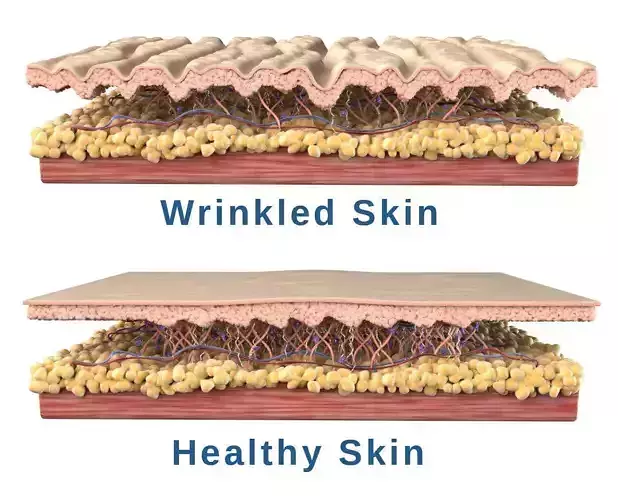 Skin Cross Section 