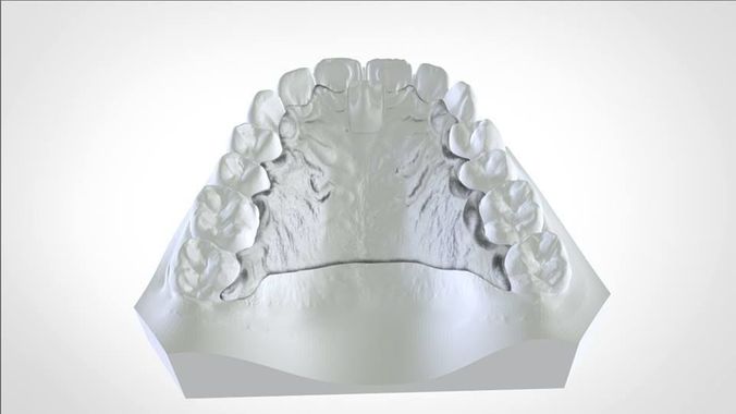 Digital Cranham Deprogrammer  3D print model