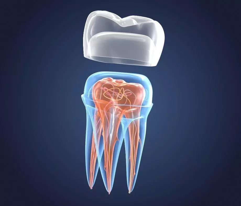 Transparent tooth and crown endodontics inner structure 3D model_0