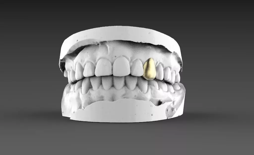 jaw teeth 3D print model
