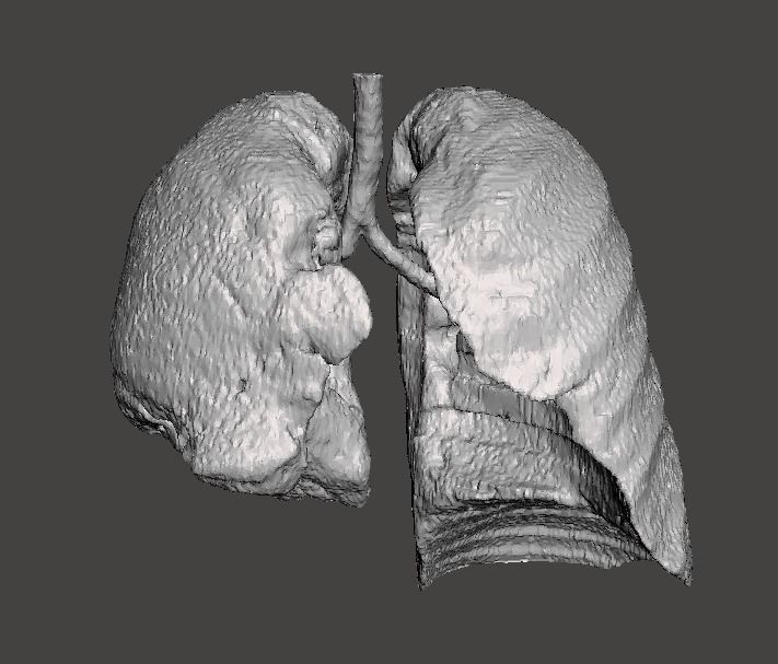 Human lungs DEMO