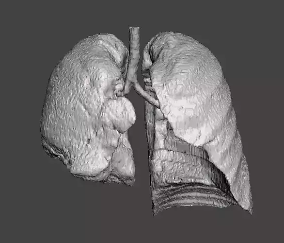 Human lungs DEMO 3D model