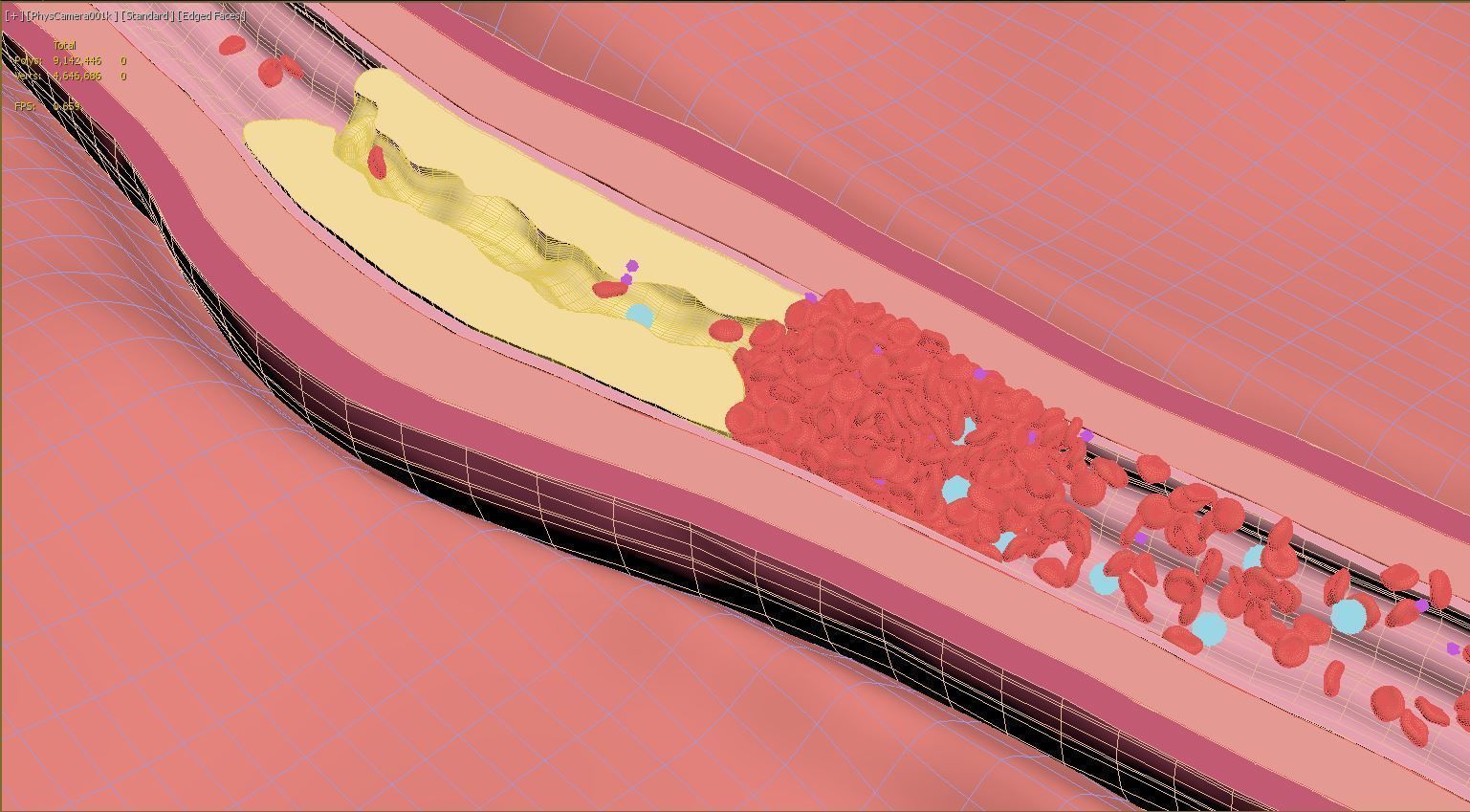 Fat Clot in Blood Stream Animation 3D model_11