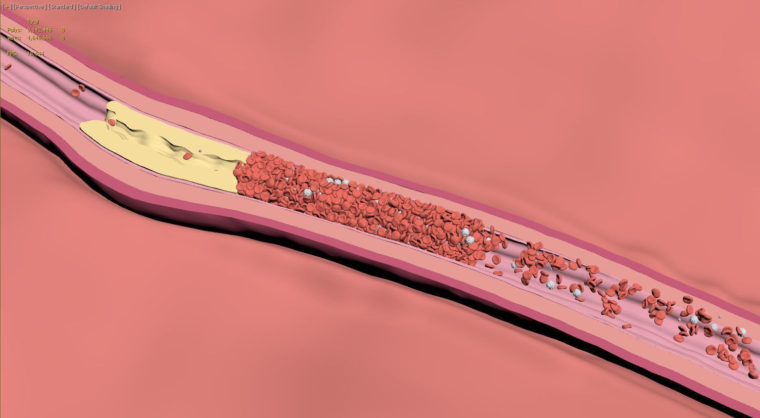 Fat Clot in Blood Stream Animation 3D model_13
