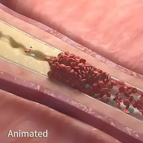 Fat Clot in Blood Stream Animation 3D model