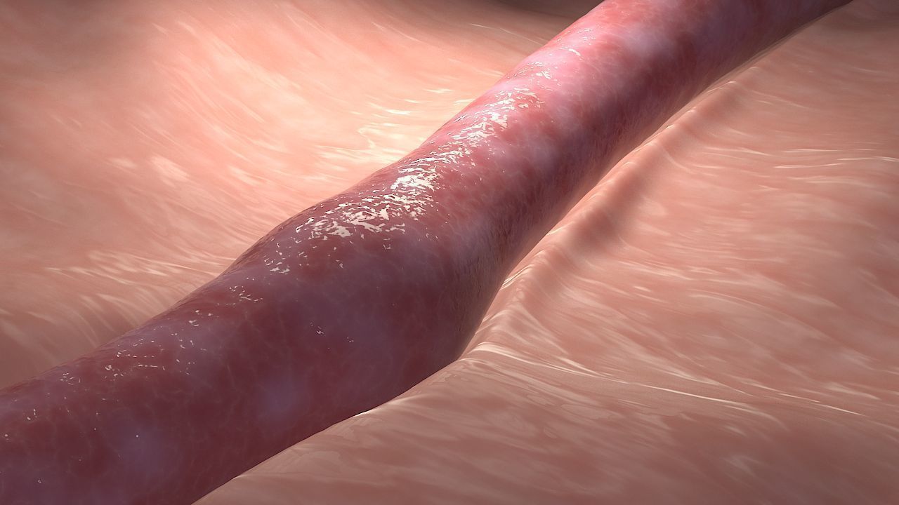 Fat Clot in Blood Stream Animation 3D model_9