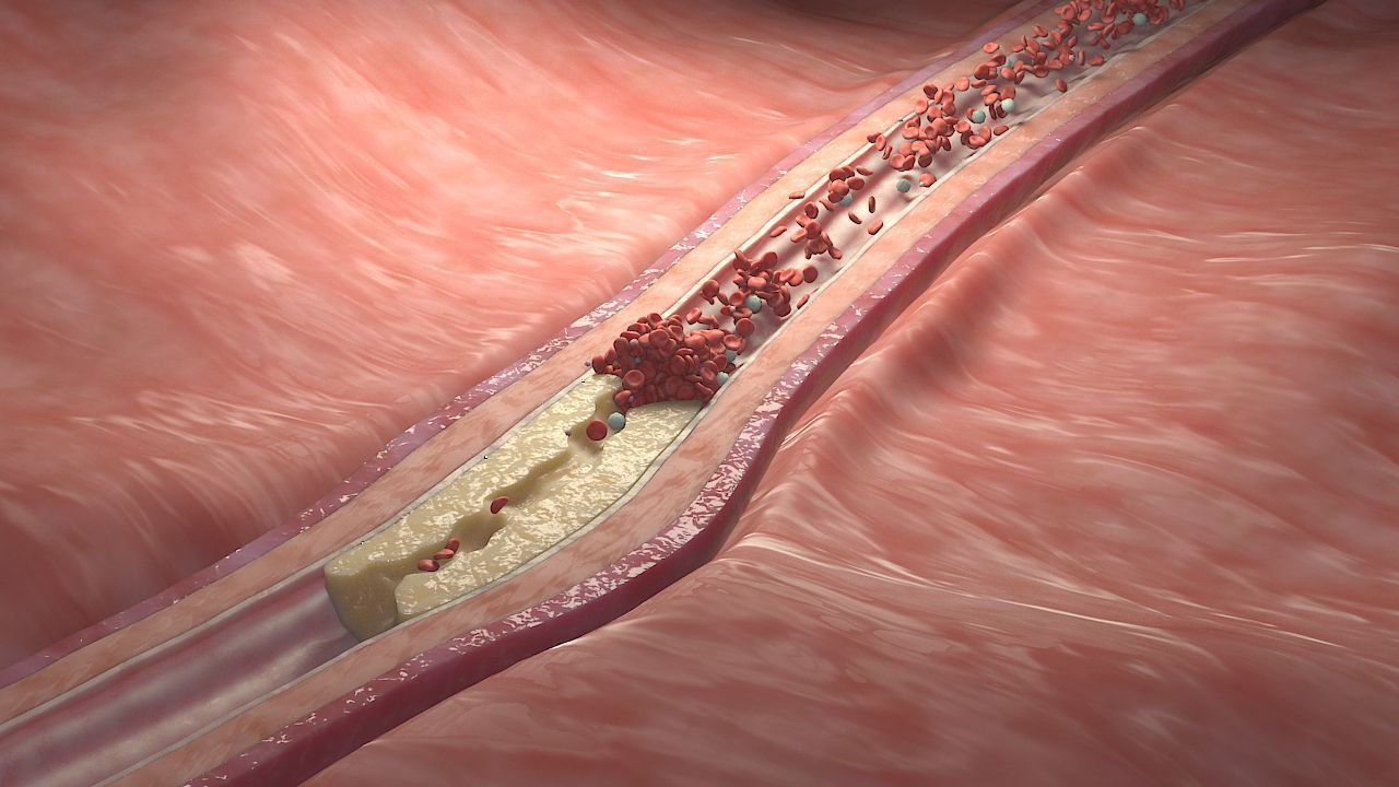 Fat Clot in Blood Stream Animation 3D model_6
