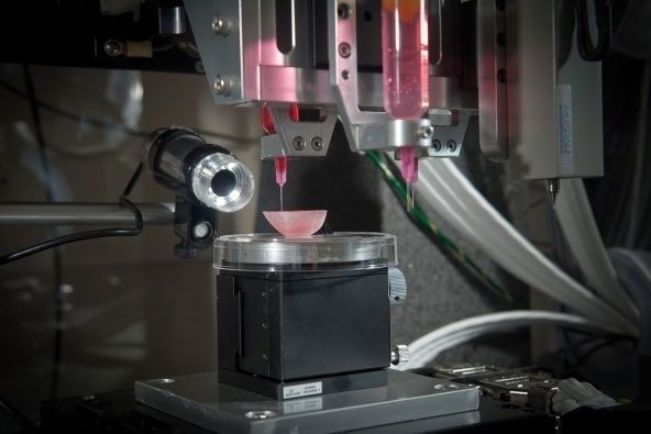 3D Printing in Medicine: How Technology Will Save Your Life 14