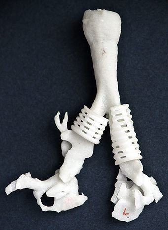 3D Printing in Medicine: How Technology Will Save Your Life 5